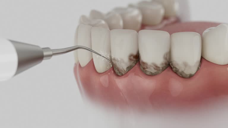 Reliable Dental contractor in Craig Beach, OH by Smile Center Dentistry